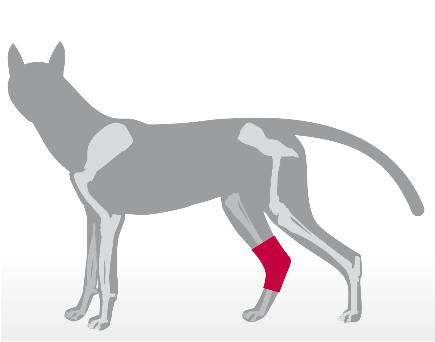 Sprunggelenkbandage aus Neopren 135°