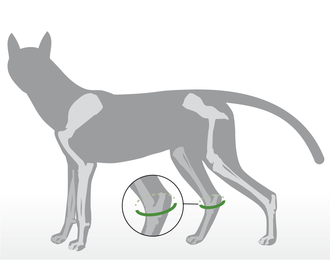 Sprunggelenkbandage Schaumstoff zur Ruhigstellung bei Bandinstabilitäten