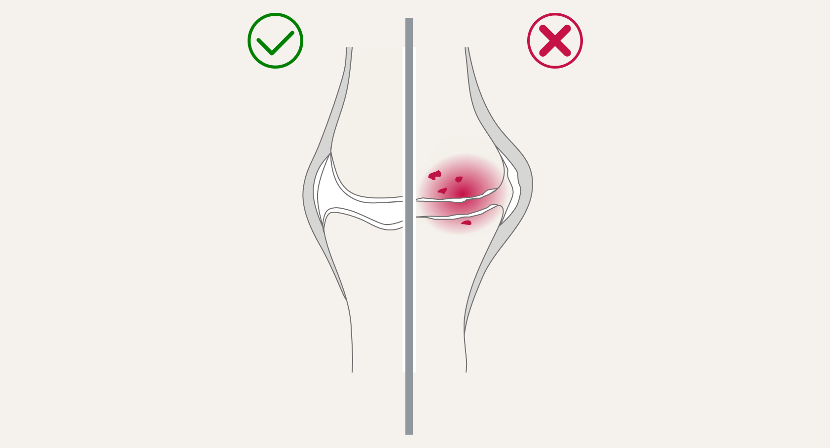Arthrose bei Hunden. Unser Diagnose-Ratgeber